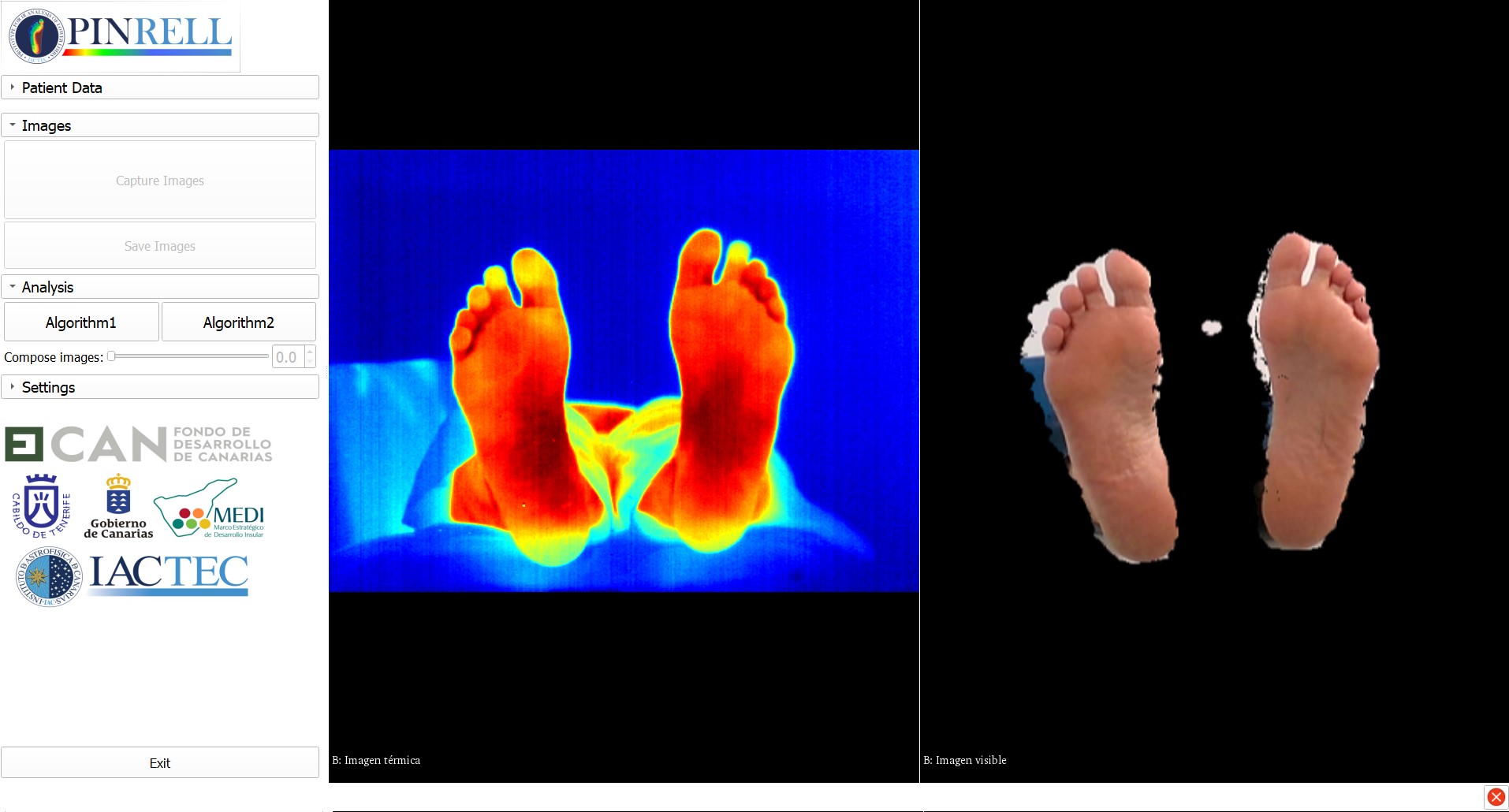 User Interface of the PINRELL system developed by the engineers of Medical Technology-IACTEC. Credit: Carlos Luque