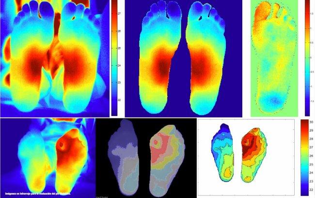 Tecnología astrofísica aplicada a la Medicina