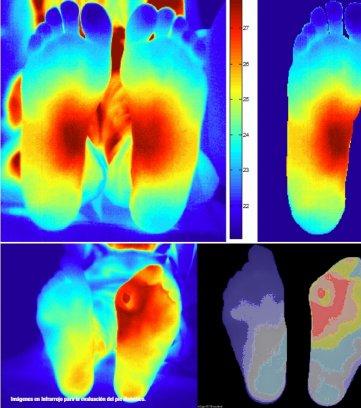 Tecnología astrofísica aplicada a la Medicina