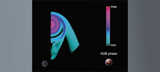 Fases AGB y post-AGB de una nebulosa planetaria simétrica de 1 masa solar que interactúa con el ISM