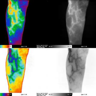 Aplicaciones médicas de la imagen Imagen termográfica del cuerpo humano